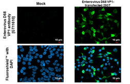 Anti-Enterovirus D68 VP1 antibody [GT11610] used in Immunocytochemistry/ Immunofluorescence (ICC/IF). GTX633688